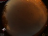 01:08:41 (*22)