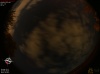 03:15:37 (*324)