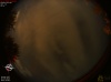 00:00:56 (*44)