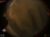 00:03:17 (*46)
