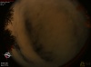 22:56:49 (*40)