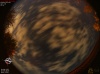 00:19:36 (*130)