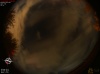 01:26:28 (*124)