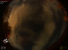 02:06:26 (*59)