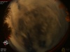 02:32:18 (*11)