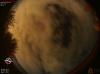 02:44:04 (*18)