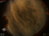 03:00:31 (*35)