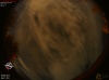 03:06:00 (*89)