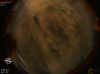 03:06:47 (*111)