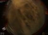 03:07:34 (*107)